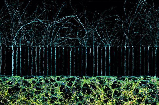 hippocampal mouse neurons
