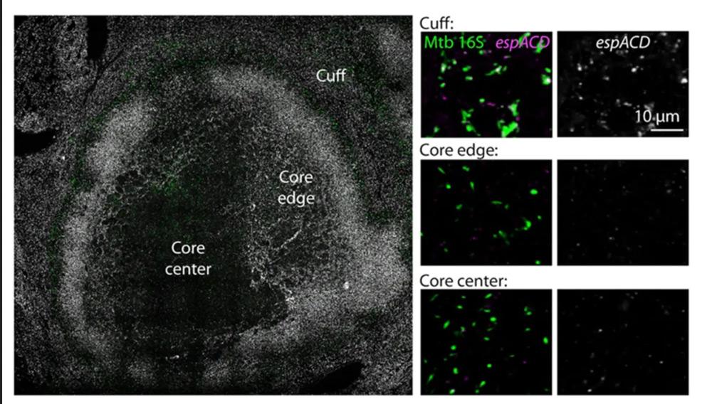  Mycobacterium tuberculosis, the pathogen that causes tuberculosis, adapts its gene expression in response to changing environmental conditions in lung tissue. Image adapted from Science Advances. doi: 10.1126/sciadv.aeb8377. 