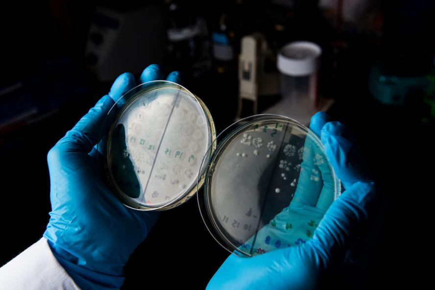 a pair of Petri dishes with germinated Clostridium difficile spores