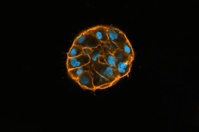 actin filaments in breast tissue