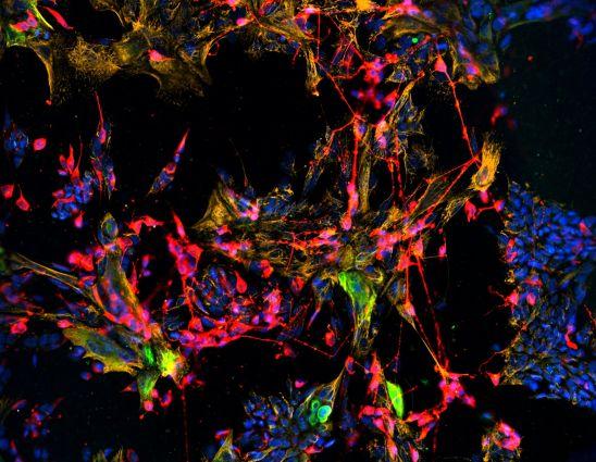 Cultured mouse horizontal basal cells can be activated to differentiate into neurons (red) and non-neuronal cells (gold) of the olfactory epithelium. 