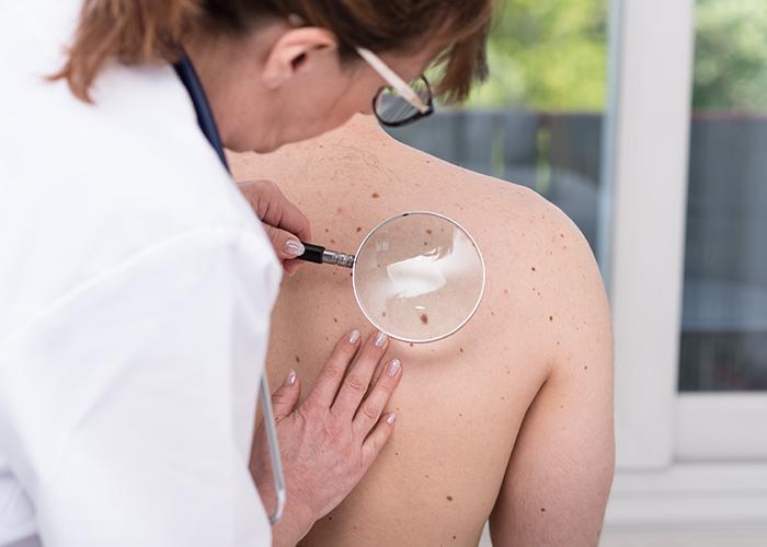 Academic Departments - Dermatology. (Adobe Stock, thodonal)
