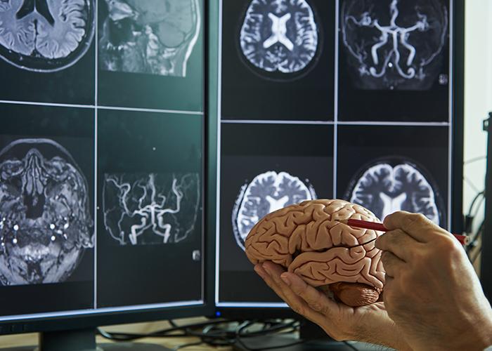Academic Departments - Neurology. (Adobe Stock, Teeradej)