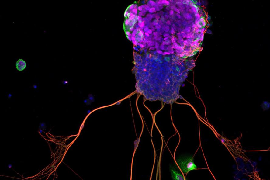  A representative picture of an organoid grown by Brian Lin and team - in fact, the researchers said, it was the first one they ever saw. 
