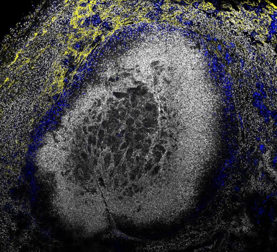 Researchers develop a method for tracking the gene expression of TB across the timecourse and location of infection