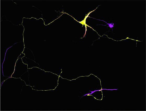 Mouse hippocampal neuron expressing a green fluorescence protein