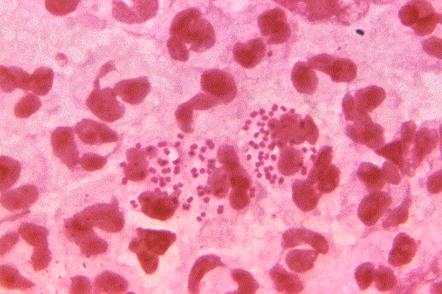 Image of microscopic gonorrhea 