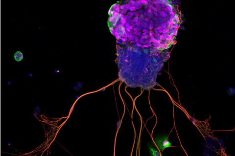  A representative picture of an organoid grown by Brian Lin and team - in fact, the researchers said, it was the first one they ever saw. 