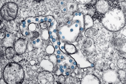 Image of an isolate from the first U.S. case of COVID-19