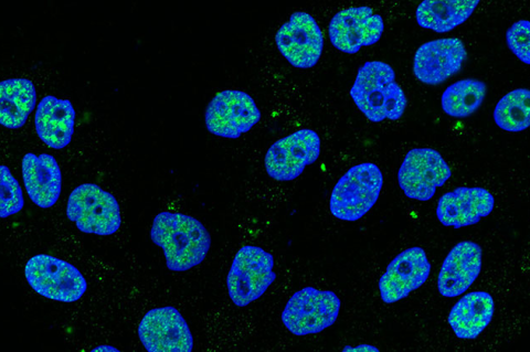 Cultured human breast cells, which are oval-shaped and blue against a black backdrop.