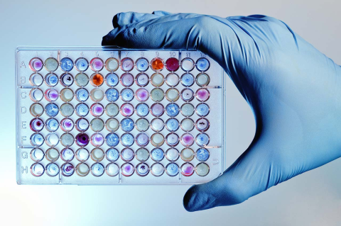 A gloved hand holds a microplate filled with samples. 