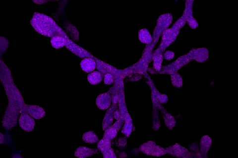 This is an image of a rabbit mammary gland organoid. Organoids are made of stem cells pushed to become specific types of organ cells. 